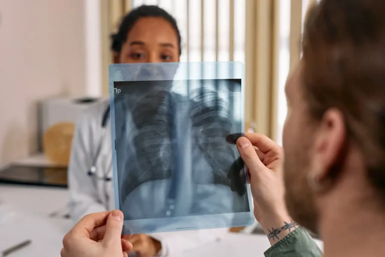 Case Study CyPath® Lung Detects Second Primary Lung Cancer