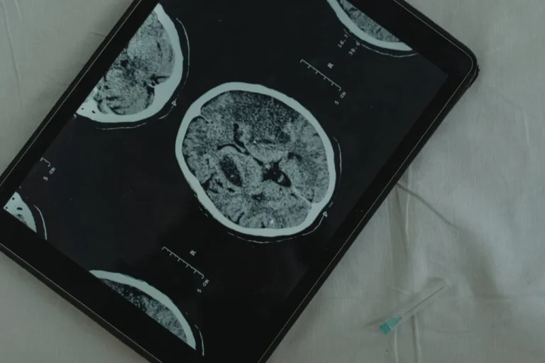 Ionis Celebrates 10 Years of Surf Away+ for Neurological Patients